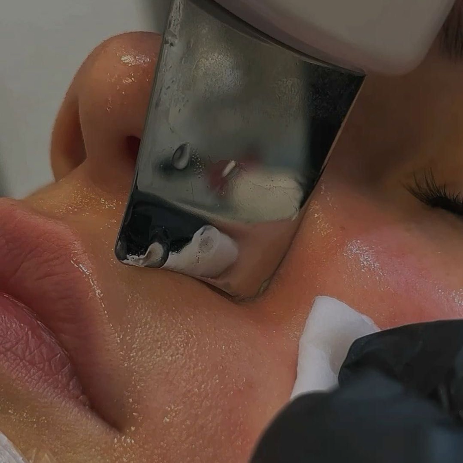 Limpieza facial “6 etapas”