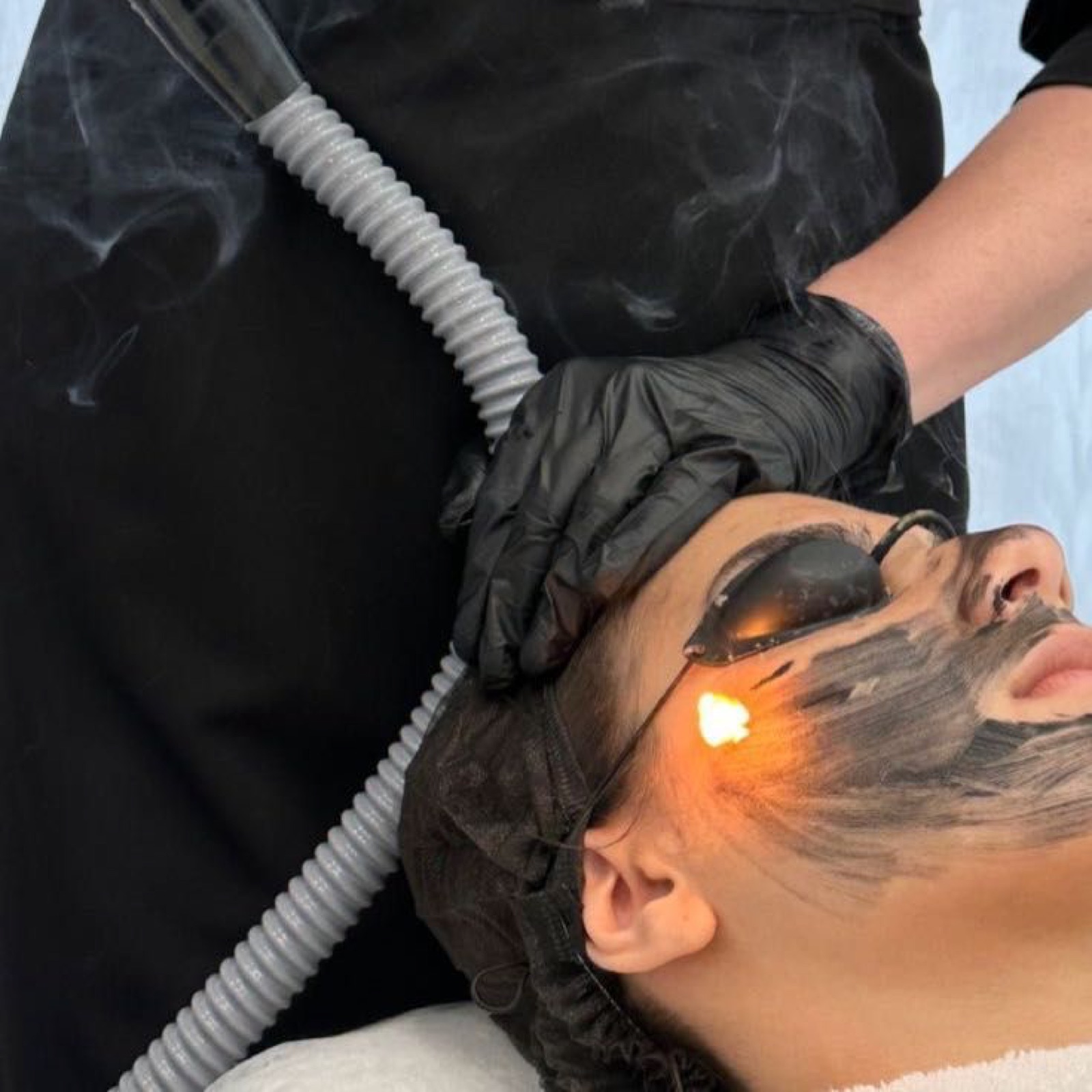 Limpieza facial + peeling de carbono